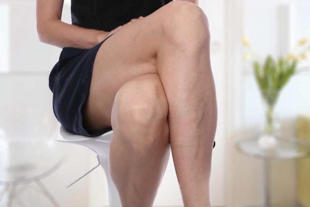 Painful varicose and spider veins on female legs